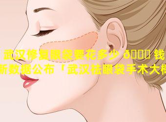 武汉修复眼袋要花多少 🐘 钱最新数据公布「武汉祛眼袋手术大概需要多少费用」